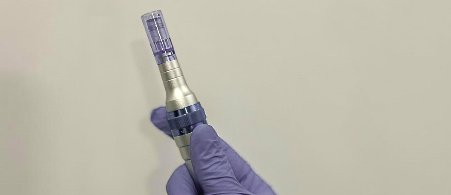 Microneedling